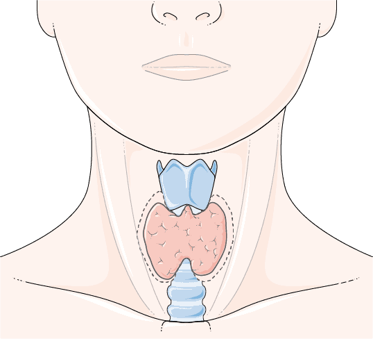 Graphic representation of the goiter Graphic representation of the goiter