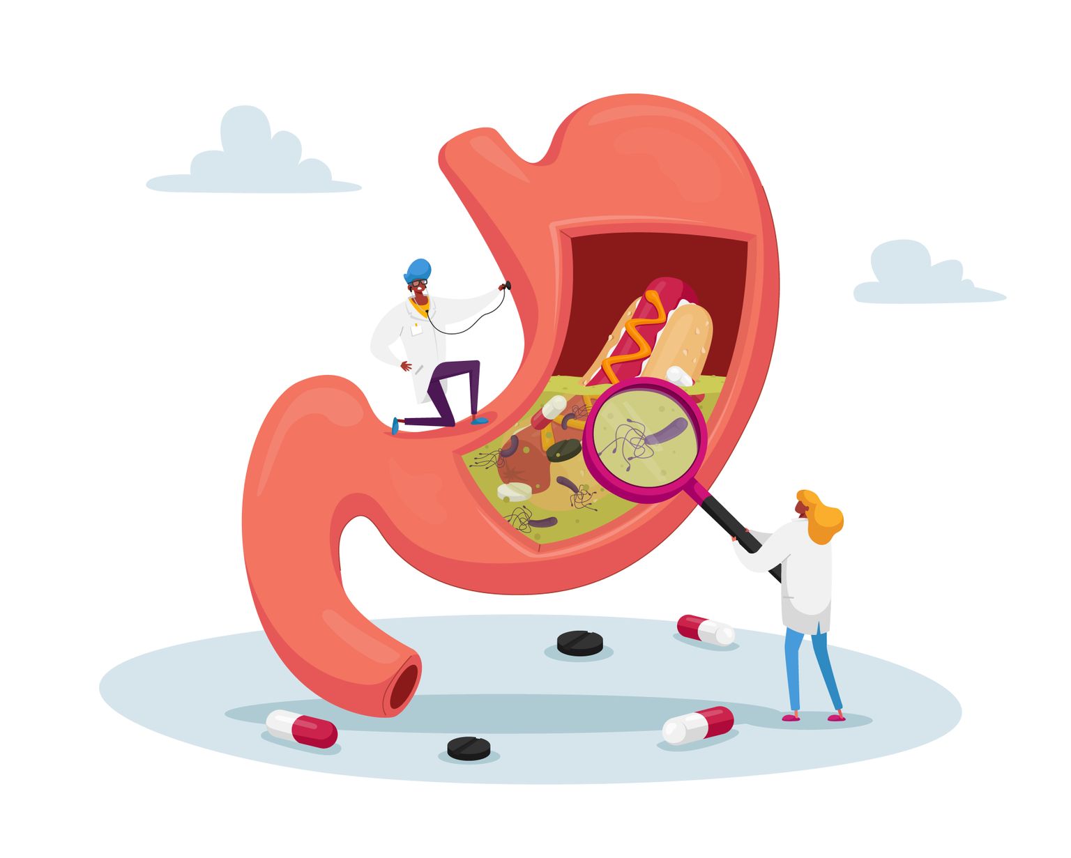 Illustrazione delle cause della gastrite