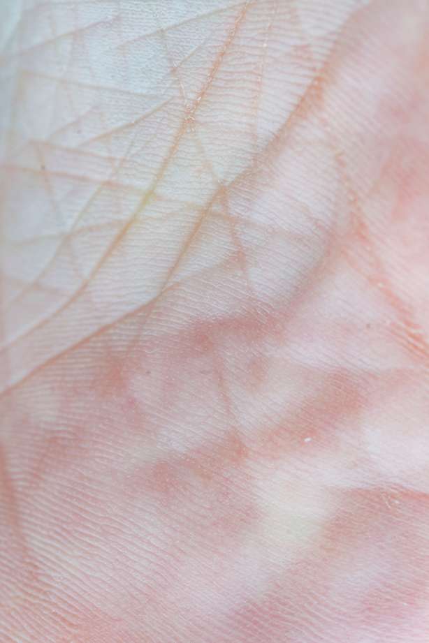 Retinol Warum empfehlen Dermatologen Retinol? Erfahren Sie mehr über seine Vorteile