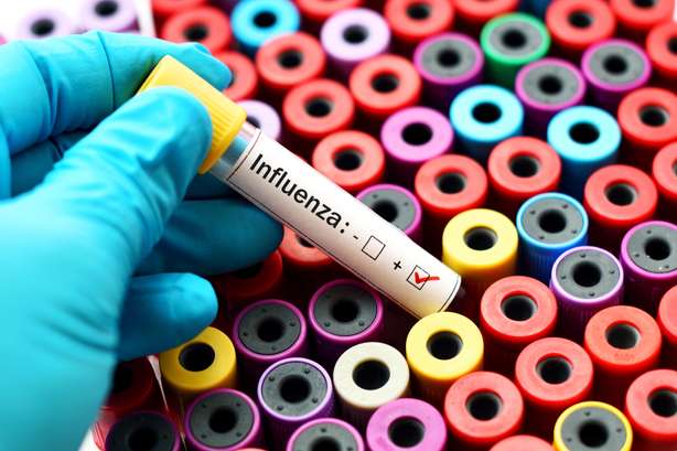 Uma amostra de sangue positiva com o vírus da gripe. Amostra de sangue positiva com o vírus da gripe
