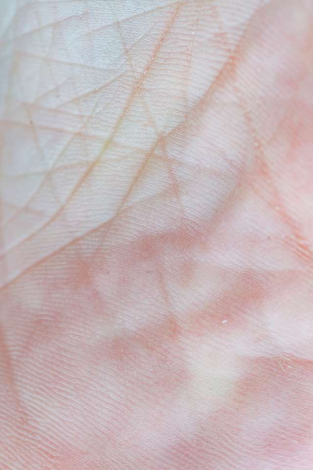 Retinol Warum empfehlen Dermatologen Retinol? Erfahren Sie mehr über seine Vorteile