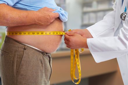 Dottore che misura il grasso corporeo di un uomo obeso. Obesità e perdita di peso.